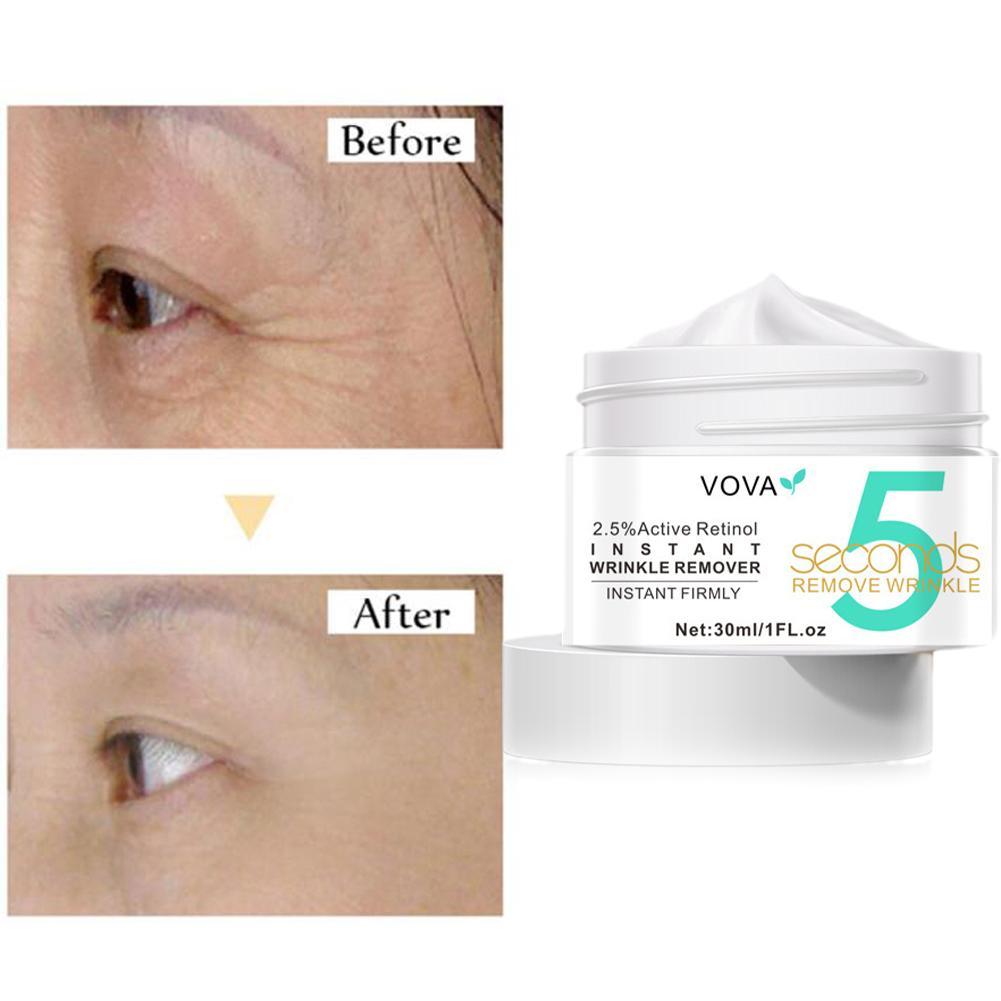 2.5% Active Retinol Eye Cream  - مراجعة Milk Thistle Silymarin وسعره